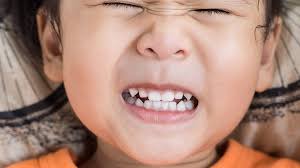 دندان قروچه در کودکان